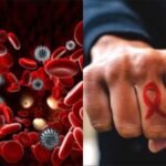 How To Know If You Are HIV/AIDS Positive