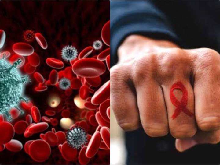 How To Know If You Are HIV/AIDS Positive