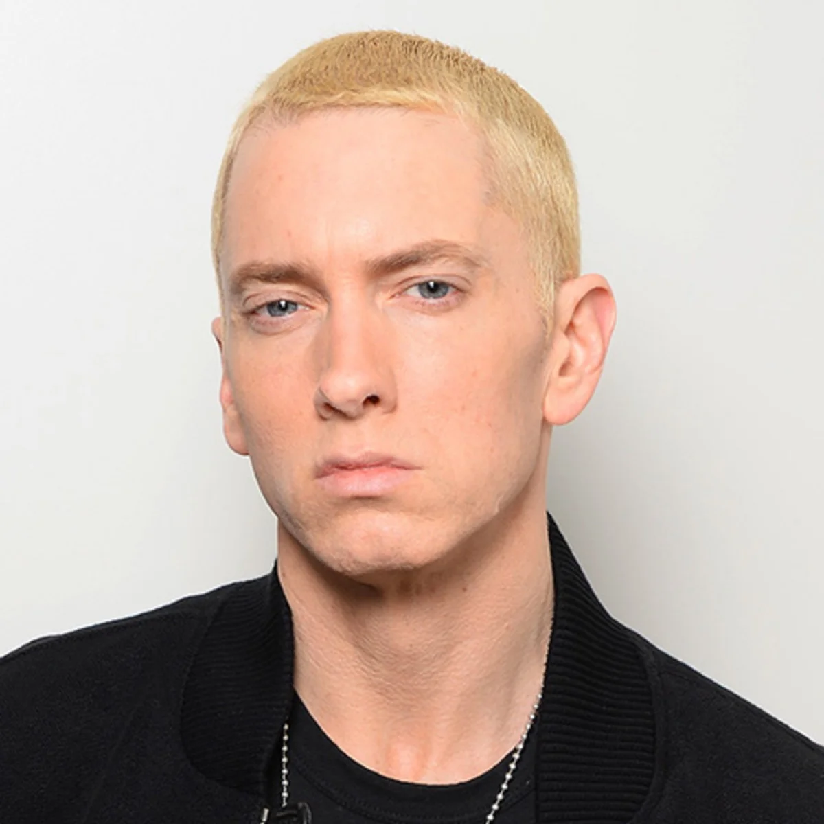 10 Celebrities You May Not Know Were Affected By Fetal Alcohol Syndrome